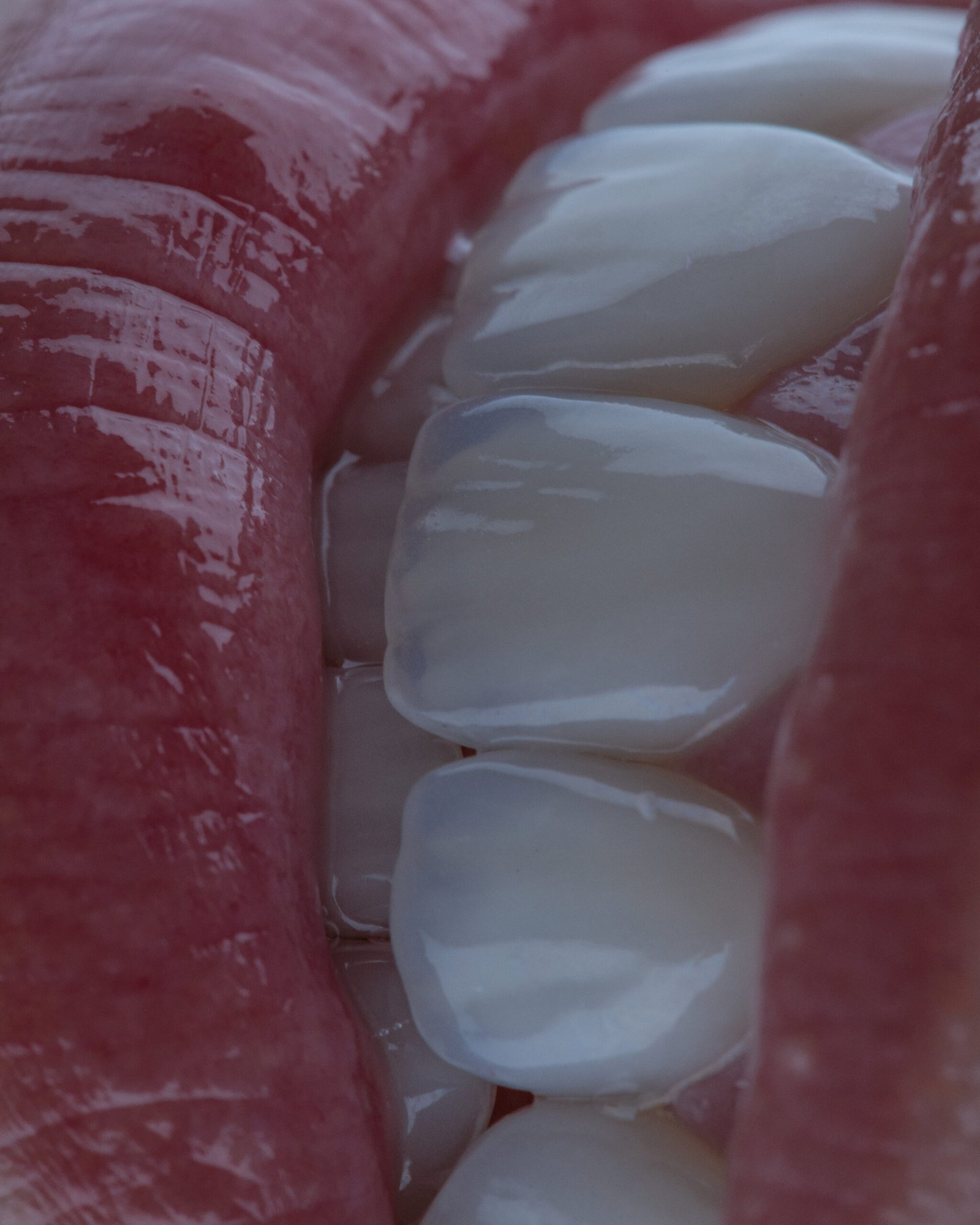 Detalle macro del borde incisal con efectos de translucidez y valor natural, recreando la juventud y vitalidad dental en el diseño de la Dra. Lina Bedoya.