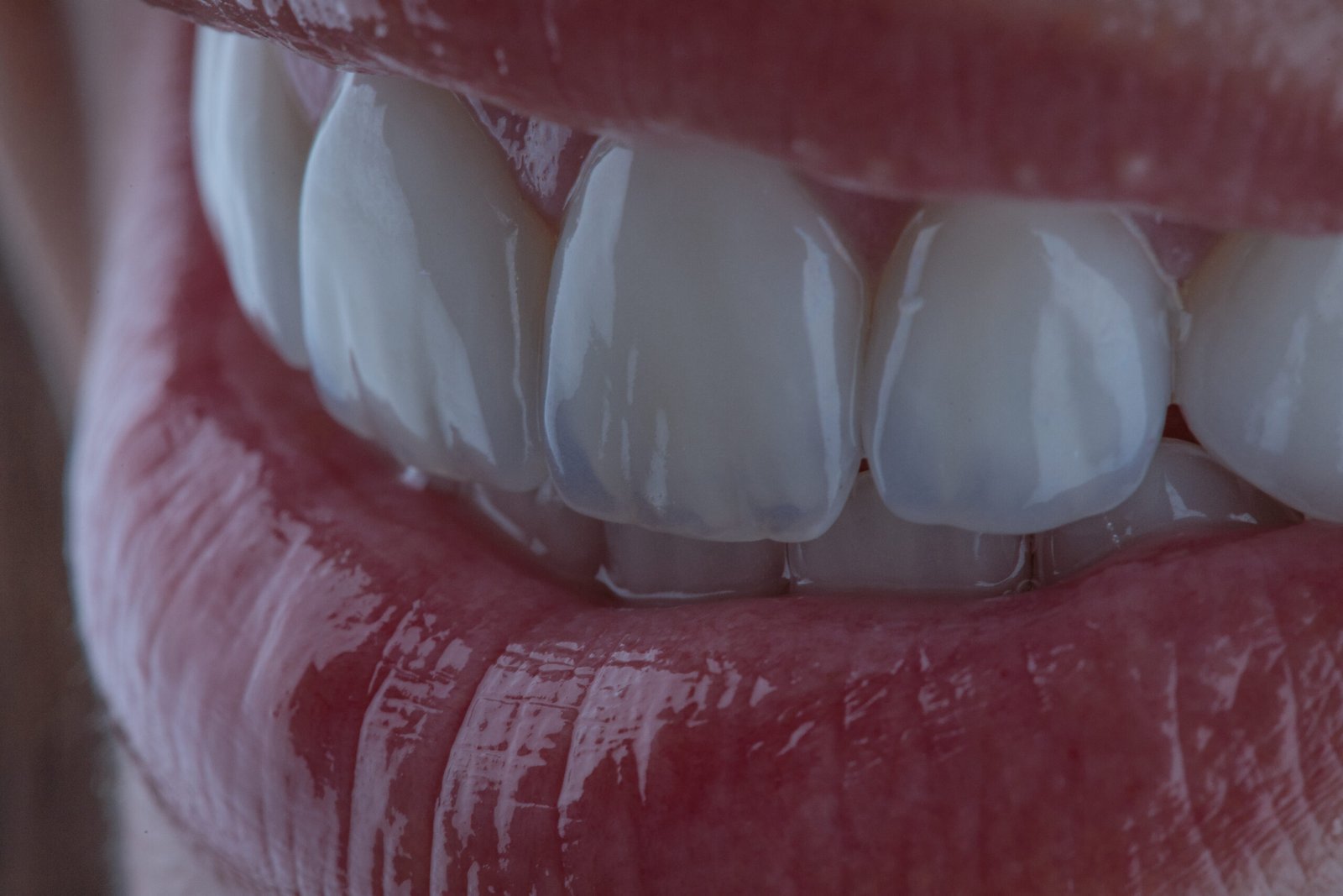 Dra. Lina Bedoya, referente en odontología de autor en Colombia, creando sonrisas únicas y personalizadas con cerámica estratificada de alta gama.