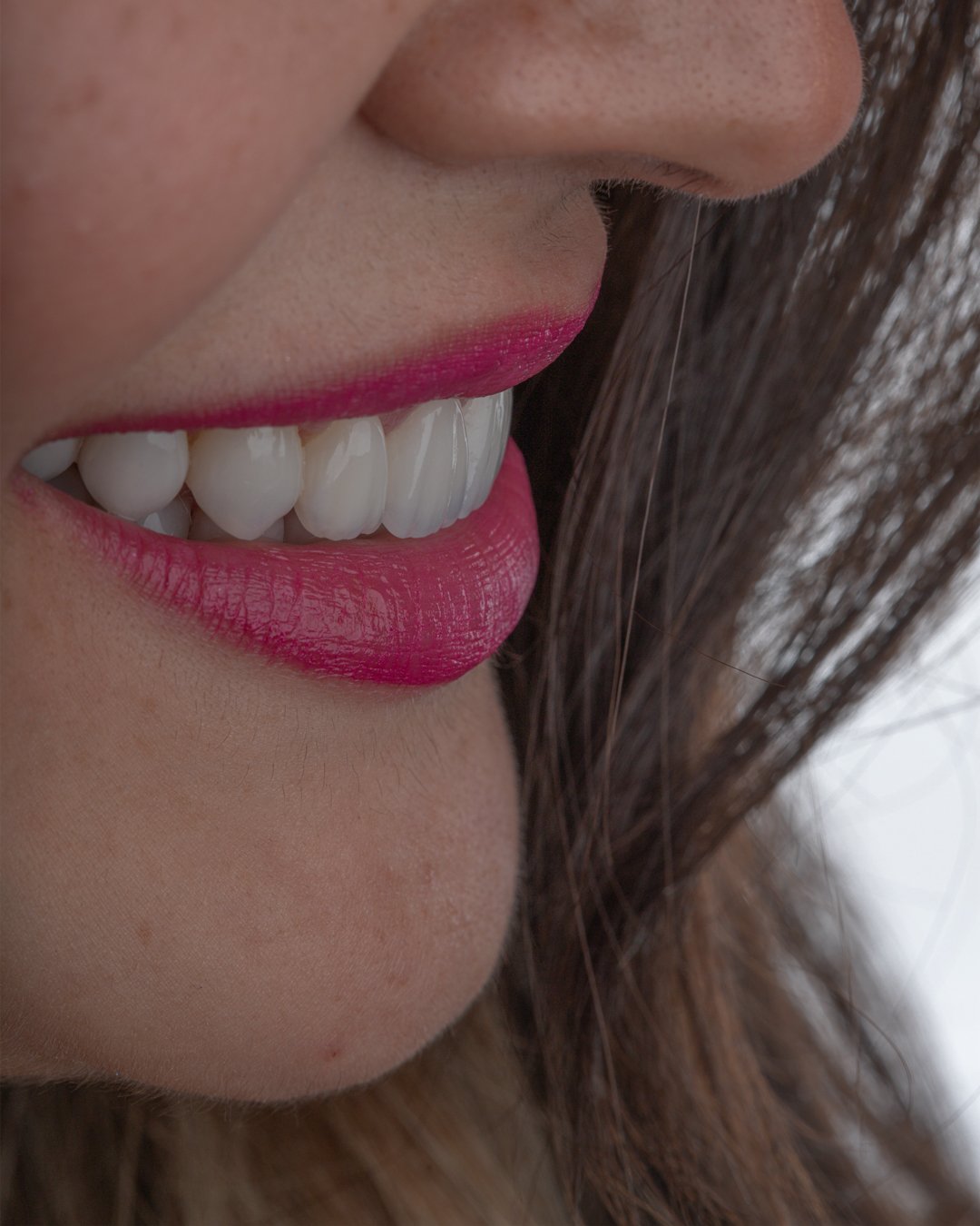 Detalle de anatomía dental avanzada lograda mediante técnica de estratificación manual en cerámica.