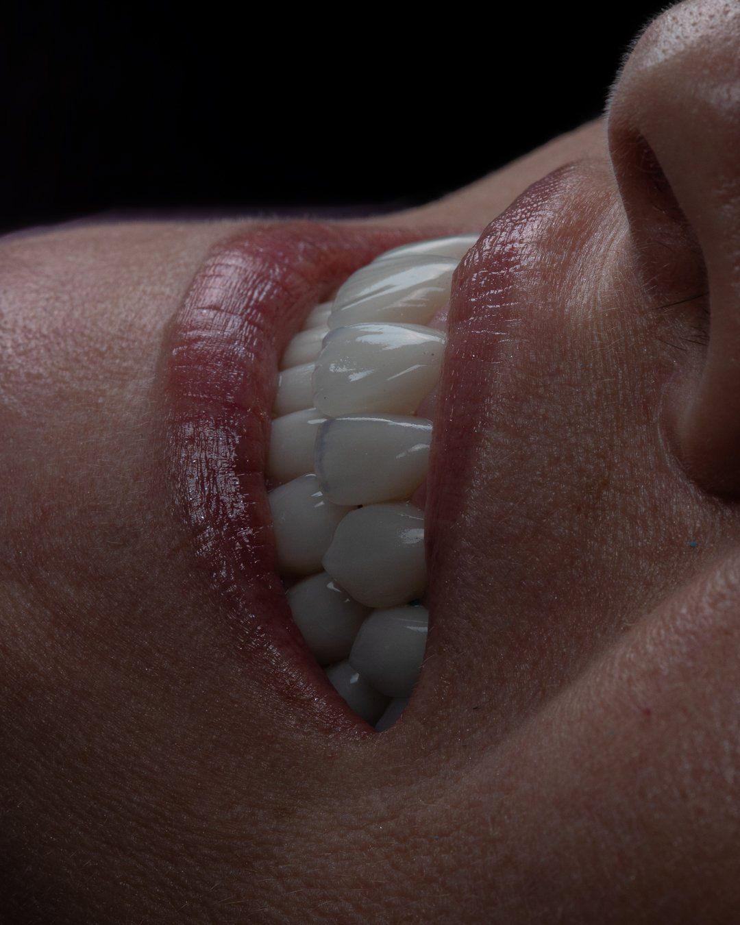 Resultado final de transformación integral: una sonrisa radiante, natural y en total equilibrio con la esencia de la paciente.